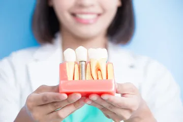 implant-2.jpg