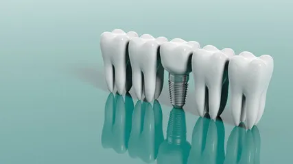 implant-3a.jpg