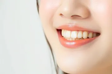 dental caries_07.jpg